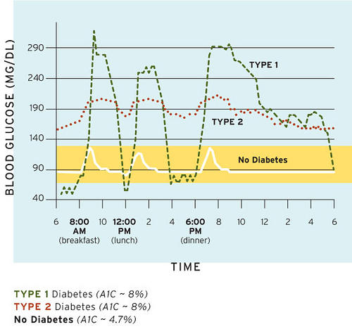 Type 1 Diabetes Blood Sugar Chart